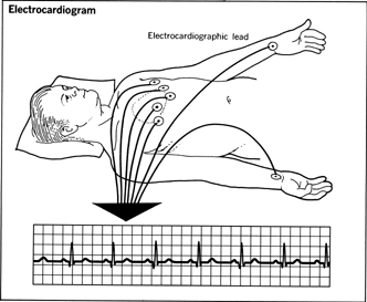 Electrocardiogram