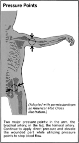 Pressure Points