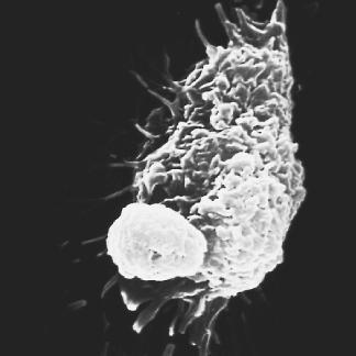 A macrophage (in background) and a lymphocyte (in foreground). Lymphocytes are one of five kinds of white blood cells that help the body's defense system fight disease. (Reproduced by permission of Institut Pasteur/Phototake NYC.)