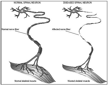 voluntary muscle cartoon