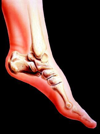 A human ankle joint. The inner and outer bulges at the ankle are formed by the ends of the tibia (the inner bulge) and fibula (the outer bulge). (Reproduced by permission of Photo Researchers, Inc.)