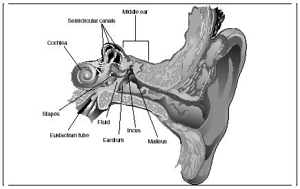 Otitis media is an infection of the middle ear space behind the eardrum. The infection poses a special problem because it often results in fluid accumulation within the middle ear. (Illustration by Electronic Illustrators Group.)