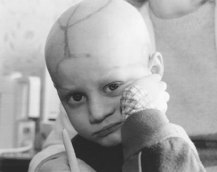 Five-year-old Alec Zhloba from a town in Belarus is suffering from leukemia. Some 70 percent of the fallout from the 1986 Chernobyl disaster fell on Belarus. (Reproduced by permission of AP/Wide World Photos)