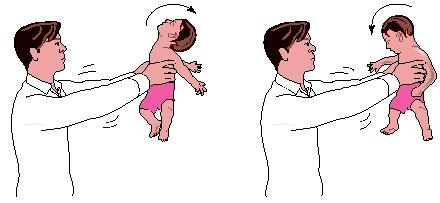 Shaking is more likely to injure a baby than an older child or adult because a baby's neck muscles are still weak, its head is still relatively large and heavy compared to its body size, and the baby's brain tissue and blood vessels are still quite fragile. (Reproduced by permission of Electronic Illustrators Group)