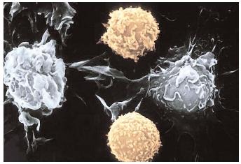 An image showing the division of cancer cells (left and right) and two healthy white blood cells (above and below). In normal cells, cell division is balanced by cell death, but cancerous cells continue to divide and accumulate, damaging nearby tissues. [Nibsc/Photo Researchers, Inc. Reproduced by permission.]