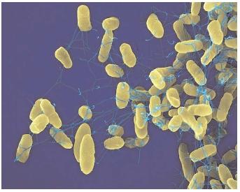 Salmonella enteritidis bacteria annually infect between two and four million people in the United States. Most outbreaks of food-borne illness are due to improper food handling or storage. [USDA/Science Source/Photo Researchers, Inc. Reproduced by permission.]