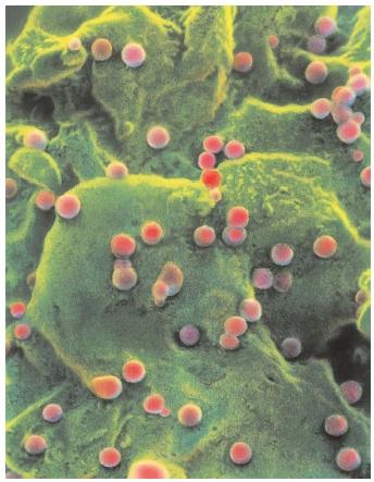 This scanning electron micrograph (SEM) shows a T-lymphocyte white blood cell, lumpy from infection. The smaller circles are AIDS viruses budding from the cell's membrane. [Nibsc/Photo Researchers, Inc. Reproduced by permission.]