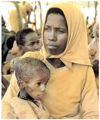  all deaths among children under five years old are due to malnutrition.