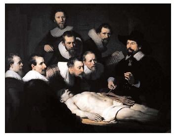 Rembrandt's "The Anatomy Lecture of Dr. Nicolaes Tulp." Dr. Tulp was a lecturer for the Amsterdam Surgeon's Guild, and among his duties was the presentation of public dissections. [© Francis G. Mayer/Corbis. Reproduced by permission.]